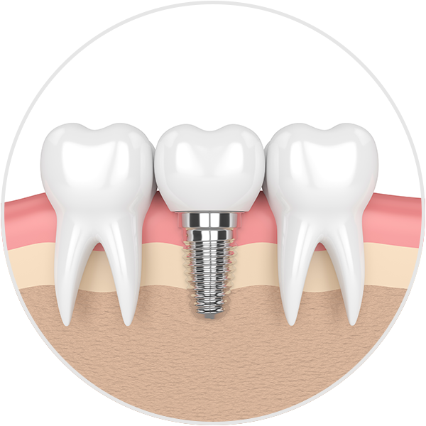 oral surgeon Madison WI - Your Teeth May Suffer If All You Eat Is